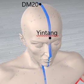 Points DM20 et Yin-Tang sur la tête