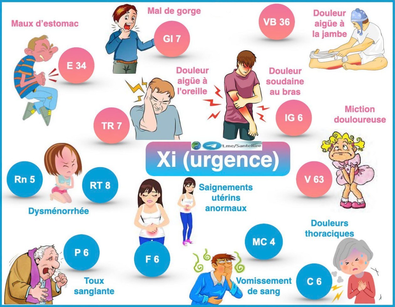 Infographie : les points Xi (urgence) en médecine chinoise et les symptômes associés — Santé Rire